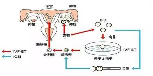 赤水捐卵手术费用查询